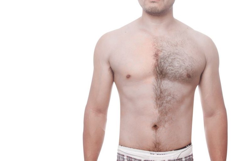 気にしたい！ 男性のムダ毛処理～除毛のすすめ[DiNOMEN リムーバークリーム（除毛クリーム）] 男性化粧品 メンズコスメ DiNOMEN（ディノメン）